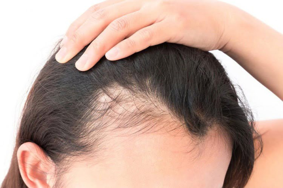 Novo produto criado por cientistas pode fazer cabelo voltar a crescer
